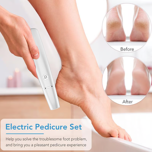 🔥Mother's Day Special🦶 Electric Foot Callus Remover