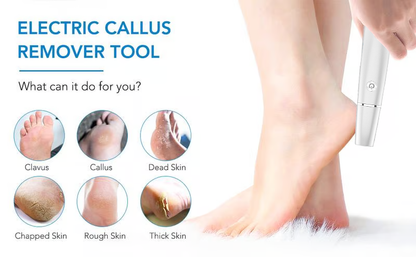 🔥Mother's Day Special🦶 Electric Foot Callus Remover