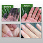 Effective Hair Dye Residue Remover（50% OFF）